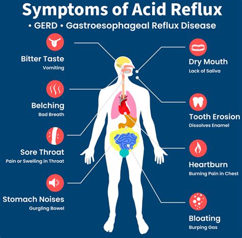 Acid Reflux Hurting Back