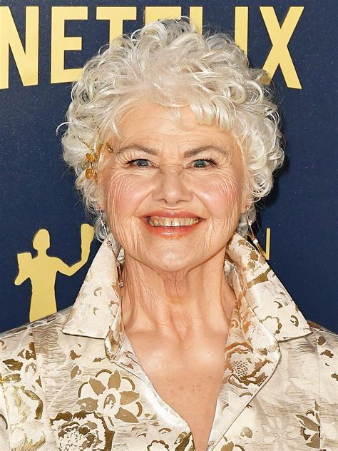 Annette Badland Face Surgery