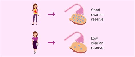 Antral Follicle Count