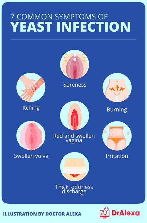 Are Yeast Infection Common