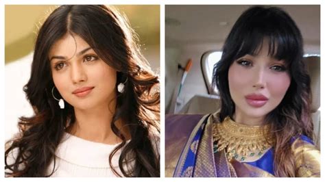 Ayesha Takia Face Surgery