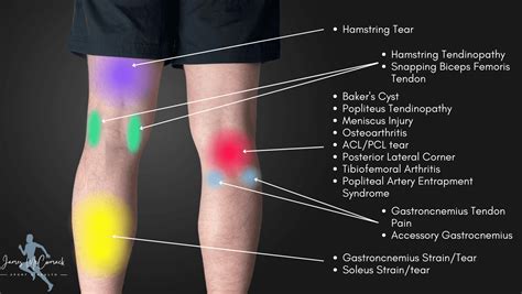 Back Of The Knee Pain