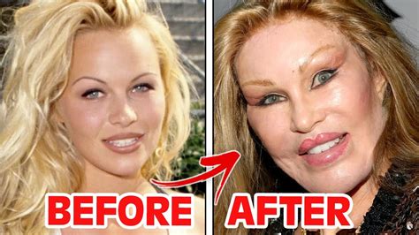 Bad Face Plastic Surgery