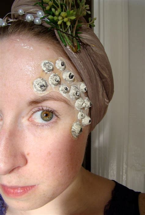 Barnacles On Skin