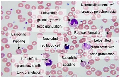 Blood Abnormalities Symptoms