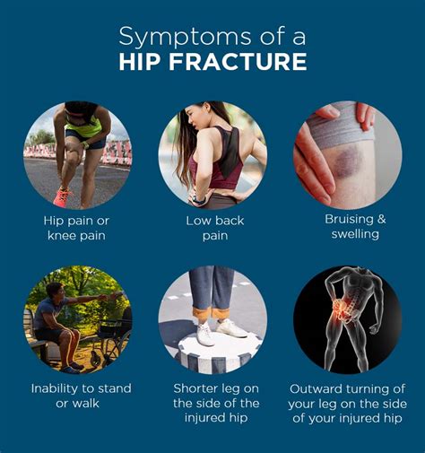 Broken Hip Symptoms