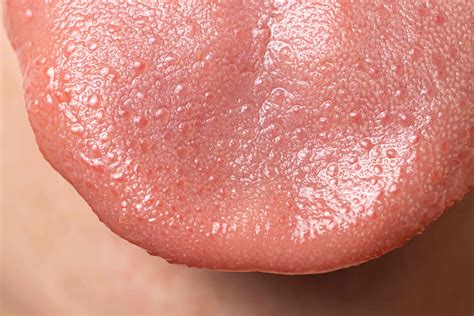 Bump Tip Tongue
