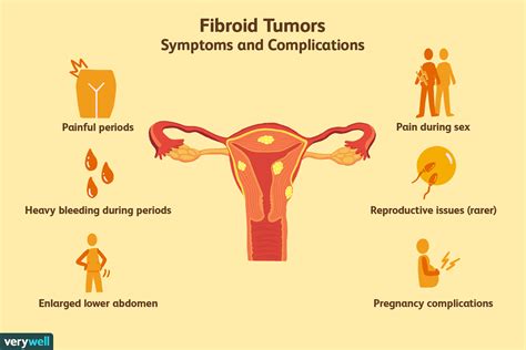 Cancerous Fibroid Tumor Symptoms