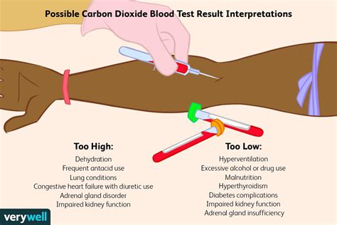 Carbon Dioxide In Blood Test