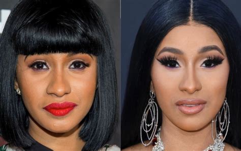 Cardi B Face Surgery