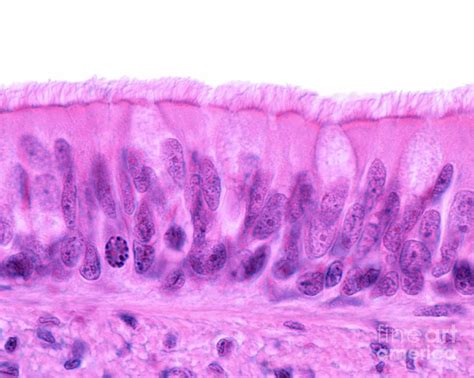 Ciliated Pseudostratified Columnar Epithelium