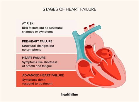 Congestive Heart Failure Stages