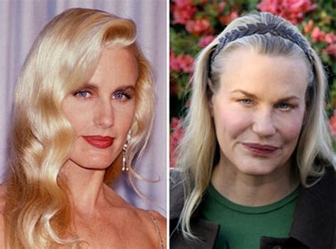 Daryl Hannah Face Surgery