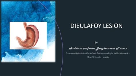 Dieu La Foy Lesion