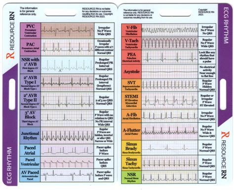 Ecg Strips