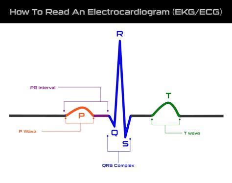 Ekg Reading
