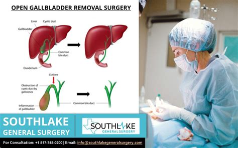 Emergency Gallbladder Removal