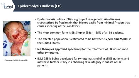 Epidermolysis Bullosa Age Expectancy