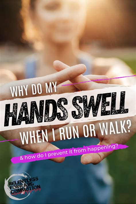 Hands Swell When Walking
