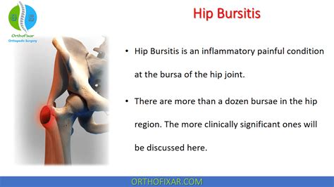 Hip Bursitis Test