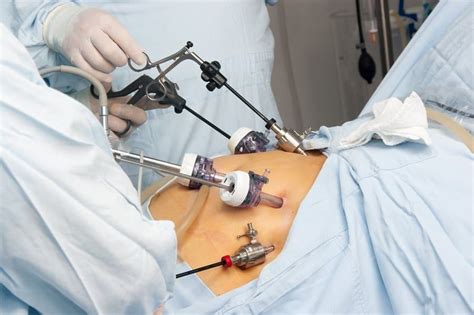 How Dangerous Is Gastric Bypass Surgery