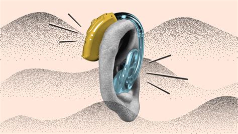 How Does Hearing Aid Work