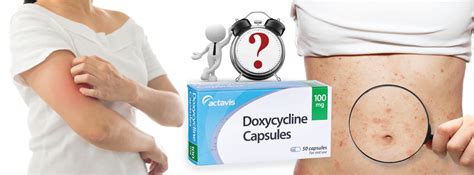 How Long Does Doxycycline Take To Work