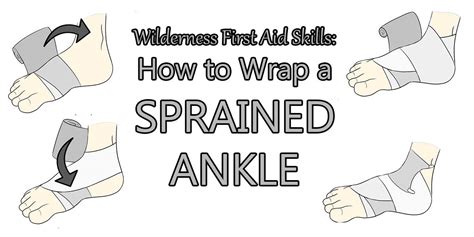 How To Wrap Sprained Ankle