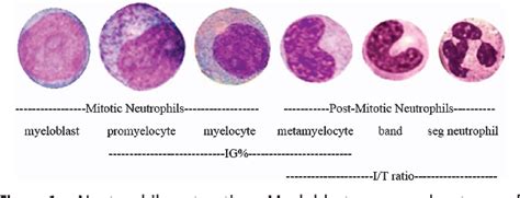 Immature Granulocytes Automated Count
