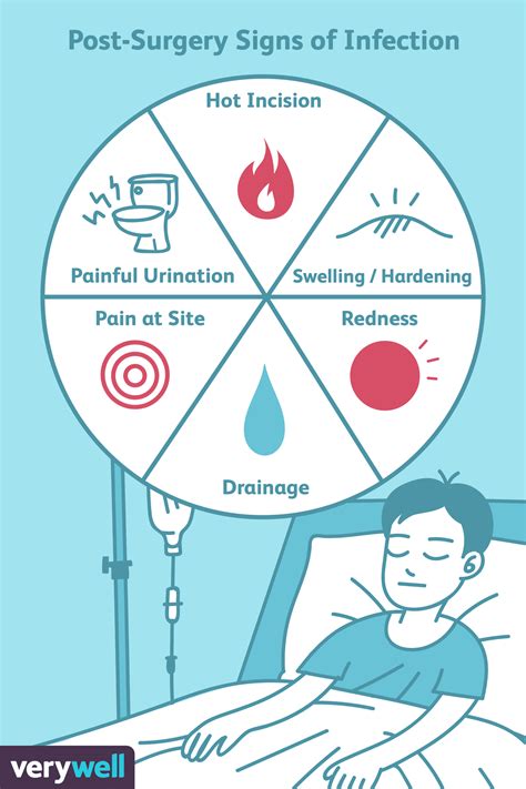 Infection After Surgery Signs