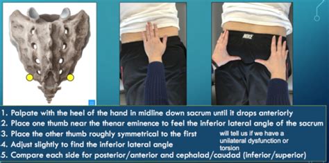 Inferior Lateral Angle