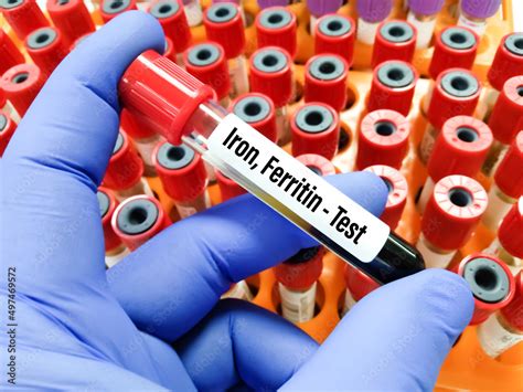 Iron Blood Test