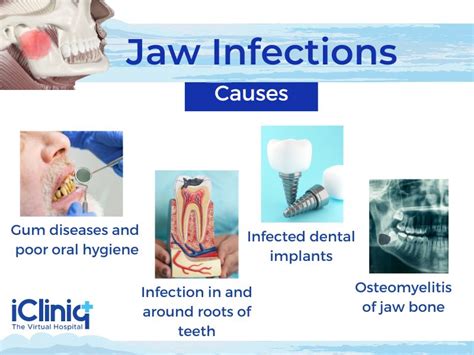 Jaw Bone Infection