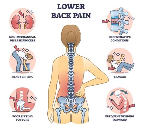 Lower Back Cause