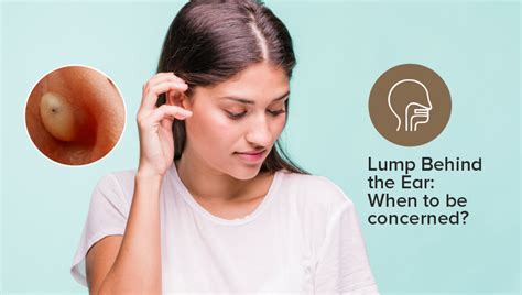 Lump Below Ear