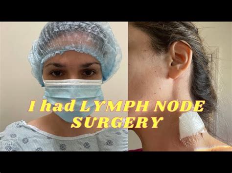Lymph Node Removal In Neck