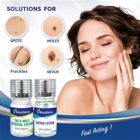 Mole Removal Cream