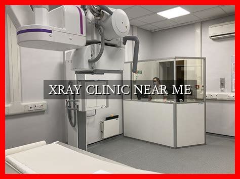 Near Me X Ray Clinic
