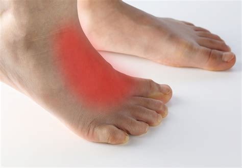 Pain Swelling Top Of Foot
