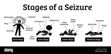Phases Of Seizure
