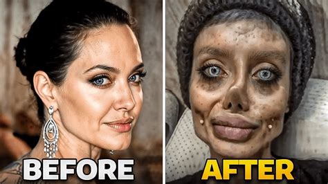 Plastic Face Surgery Gone Wrong