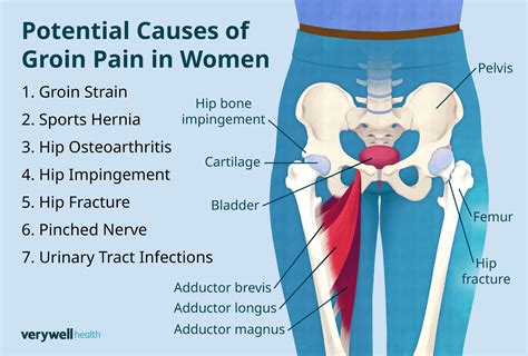 Pregnant Groin Hurts