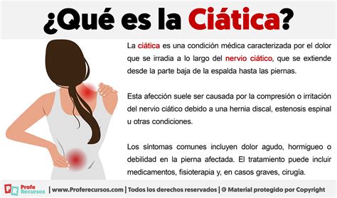 Que Es La Ciática