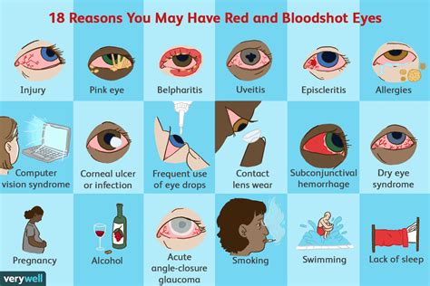 Red Eye Causes