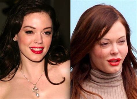 Rose Mcgowan Face Surgery