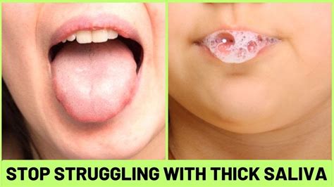 Saliva Is Thicker
