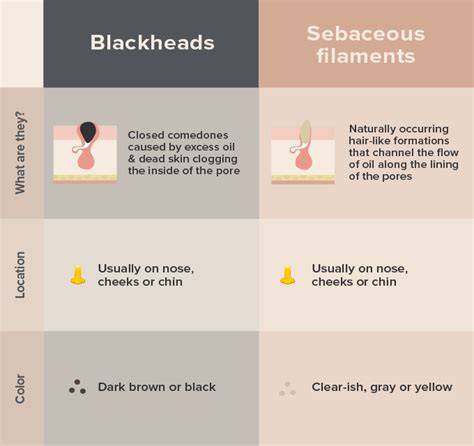 Sebaceous Filament Vs Blackhead