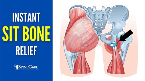 Sit Bone Pain