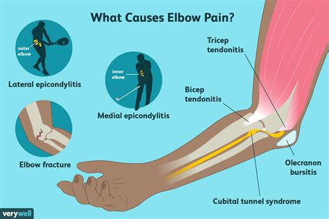 Sore Left Elbow Joint