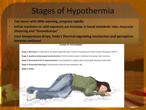 Stages Of Hypothermia